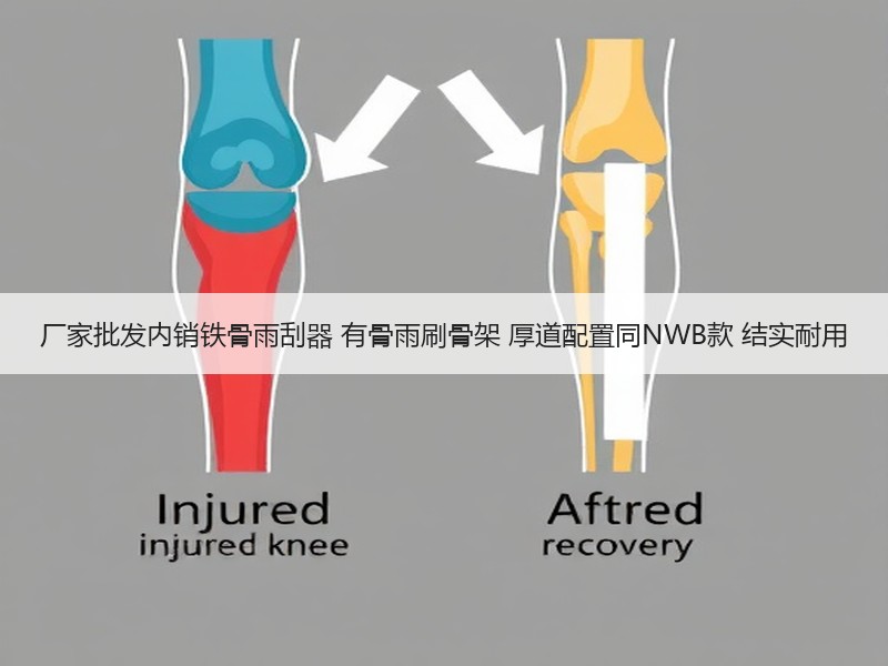 厂家批发内销铁骨雨刮器 有骨雨刷骨架 厚道配置同NWB款 结实耐用 厂家批发内销铁骨雨刮器 有骨雨刷骨架 厚道配置同NWB款 结实耐用